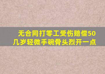 无合同打零工受伤赔偿50几岁轻微手碗骨头烈开一点